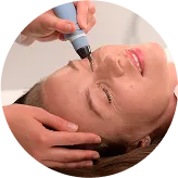 exion rf microneedling circle 2