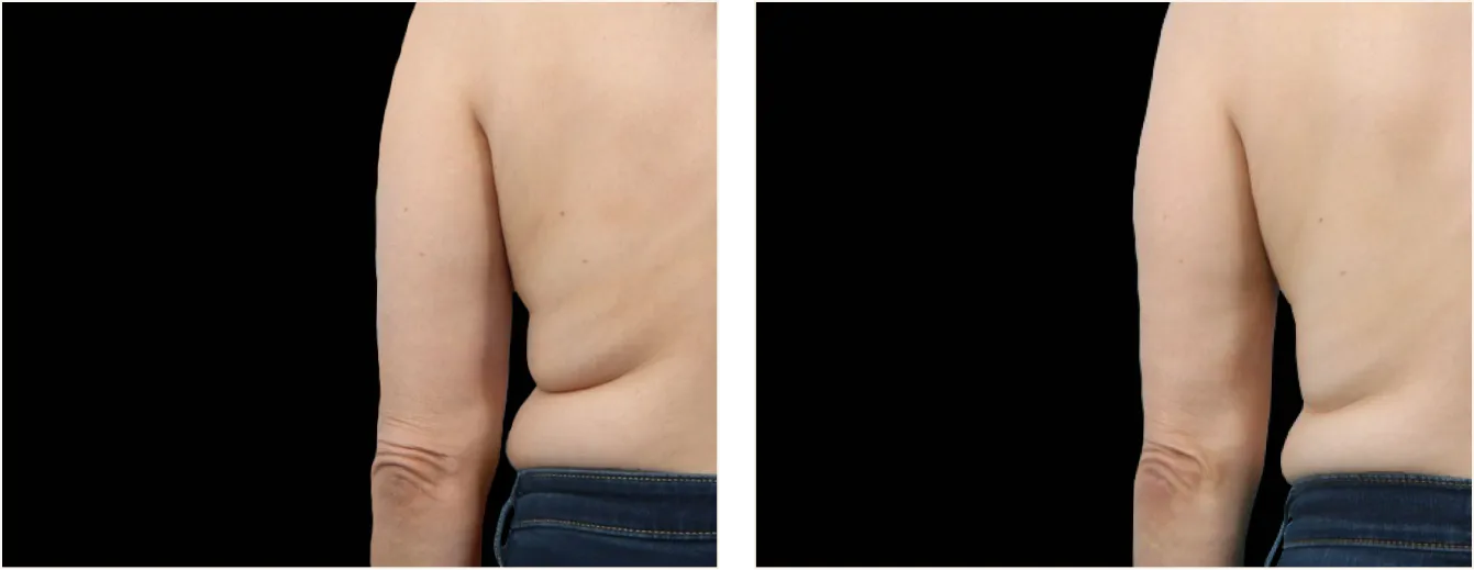 exion body vartalo example 1