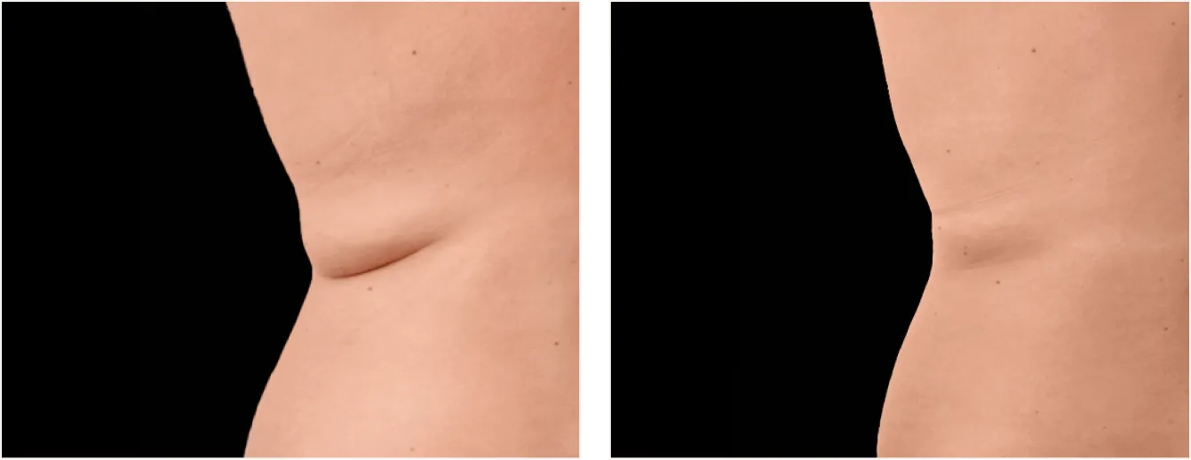 exion body vartalo example 2