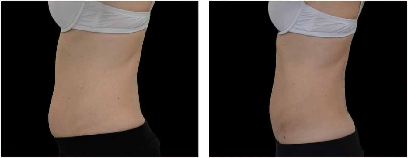 exion body vatsa example 2