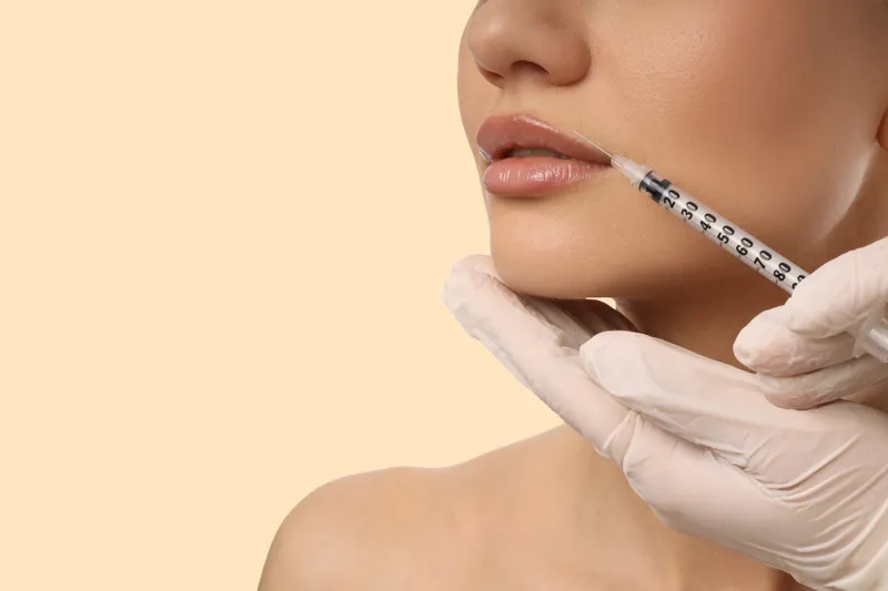 Lip filler treatment