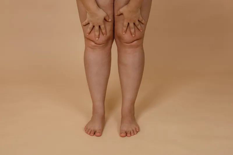 Loose thighs image 1