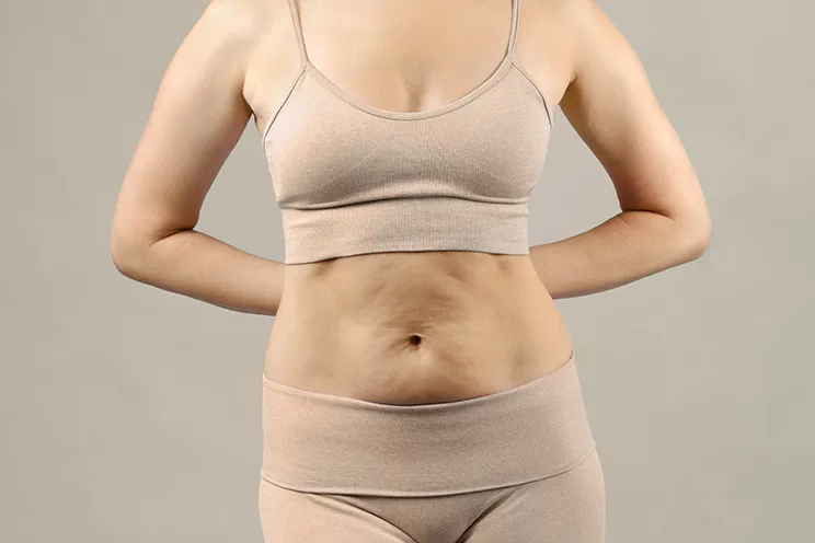 Skin sagging image 1