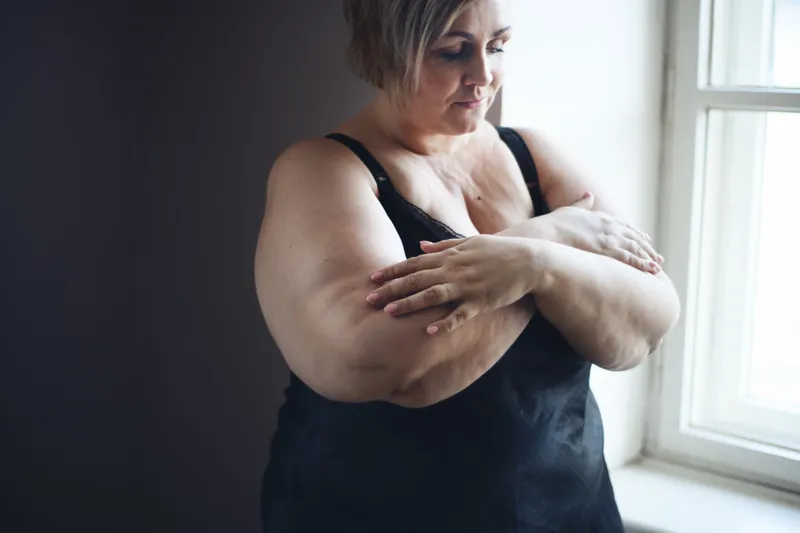 Thick arms image 1