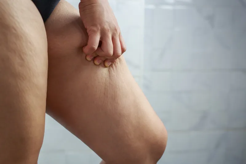 Loose thighs image 2