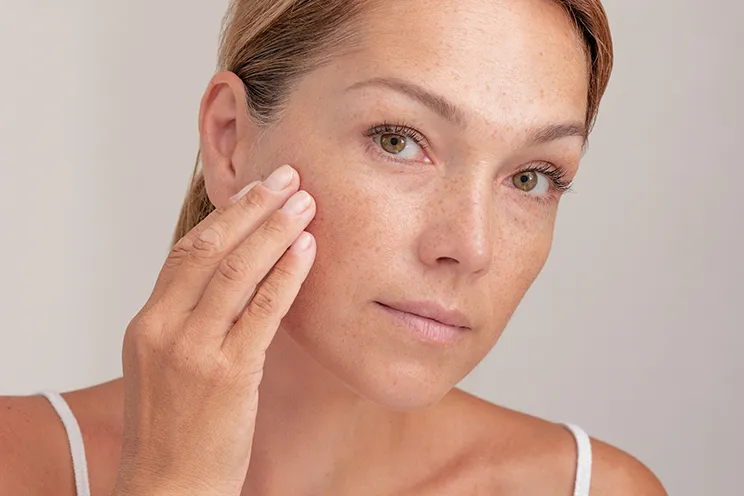 Pigmentation image 2