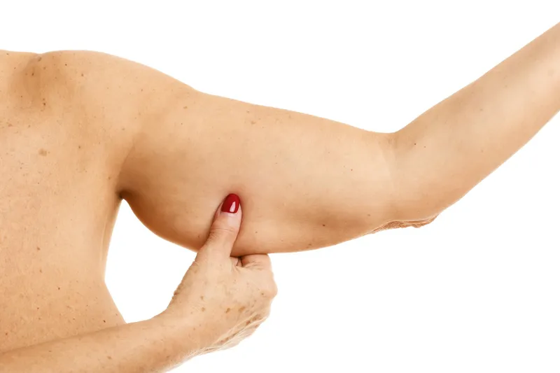 Thick arms image 2