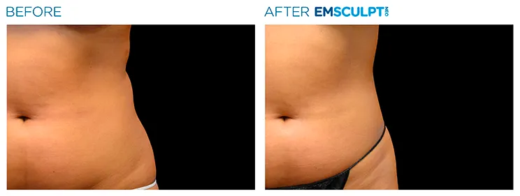 Love handles image 4