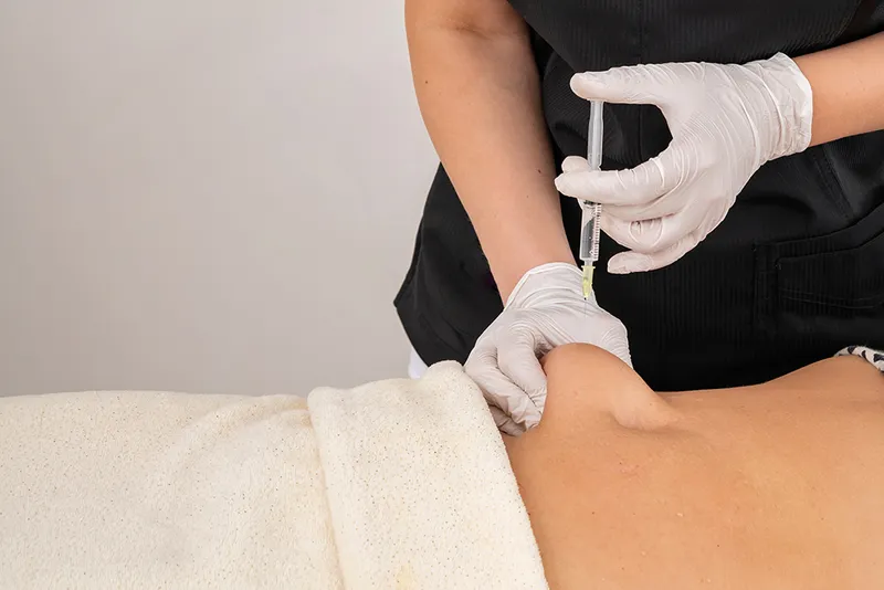 Lipolytic treatment image 1