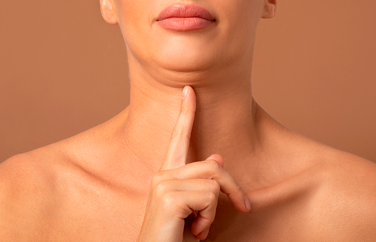 Double chin image 1