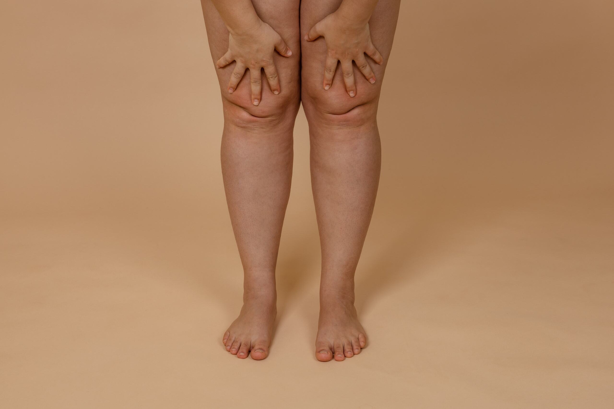 Loose thighs image 1