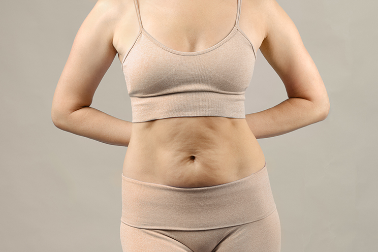 Skin sagging image 1