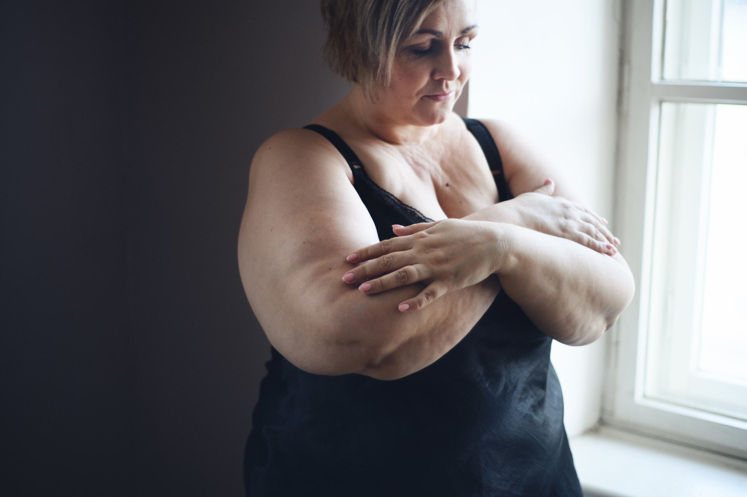 Thick arms image 1