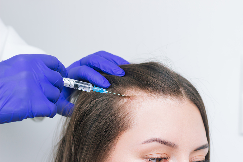 Mesotherapy for hair treatment image 2