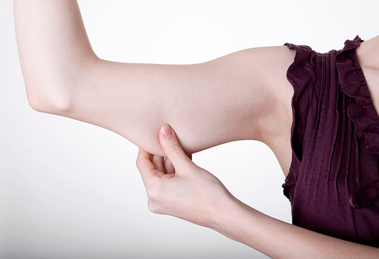 Skin sagging image 2