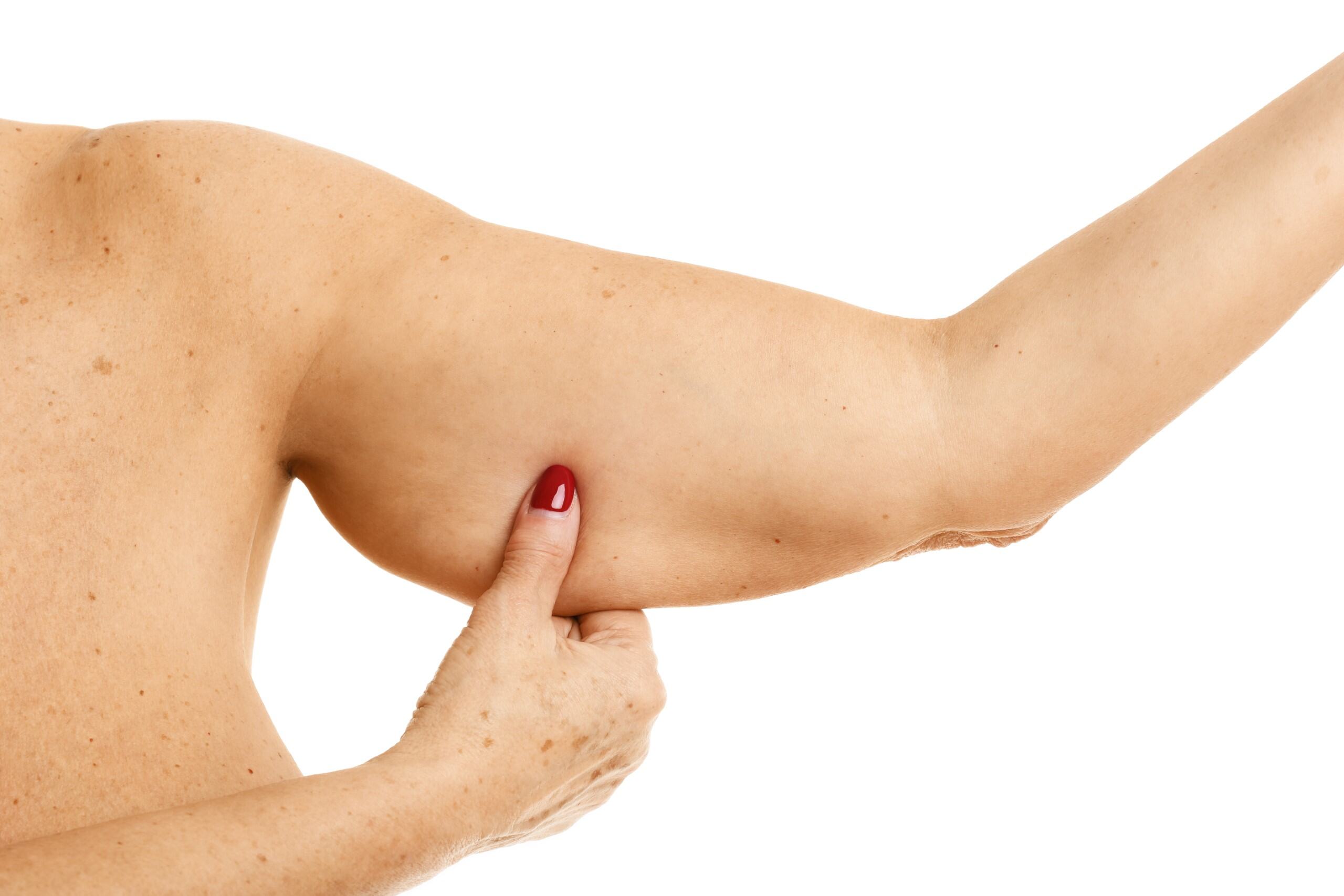 Thick arms image 2