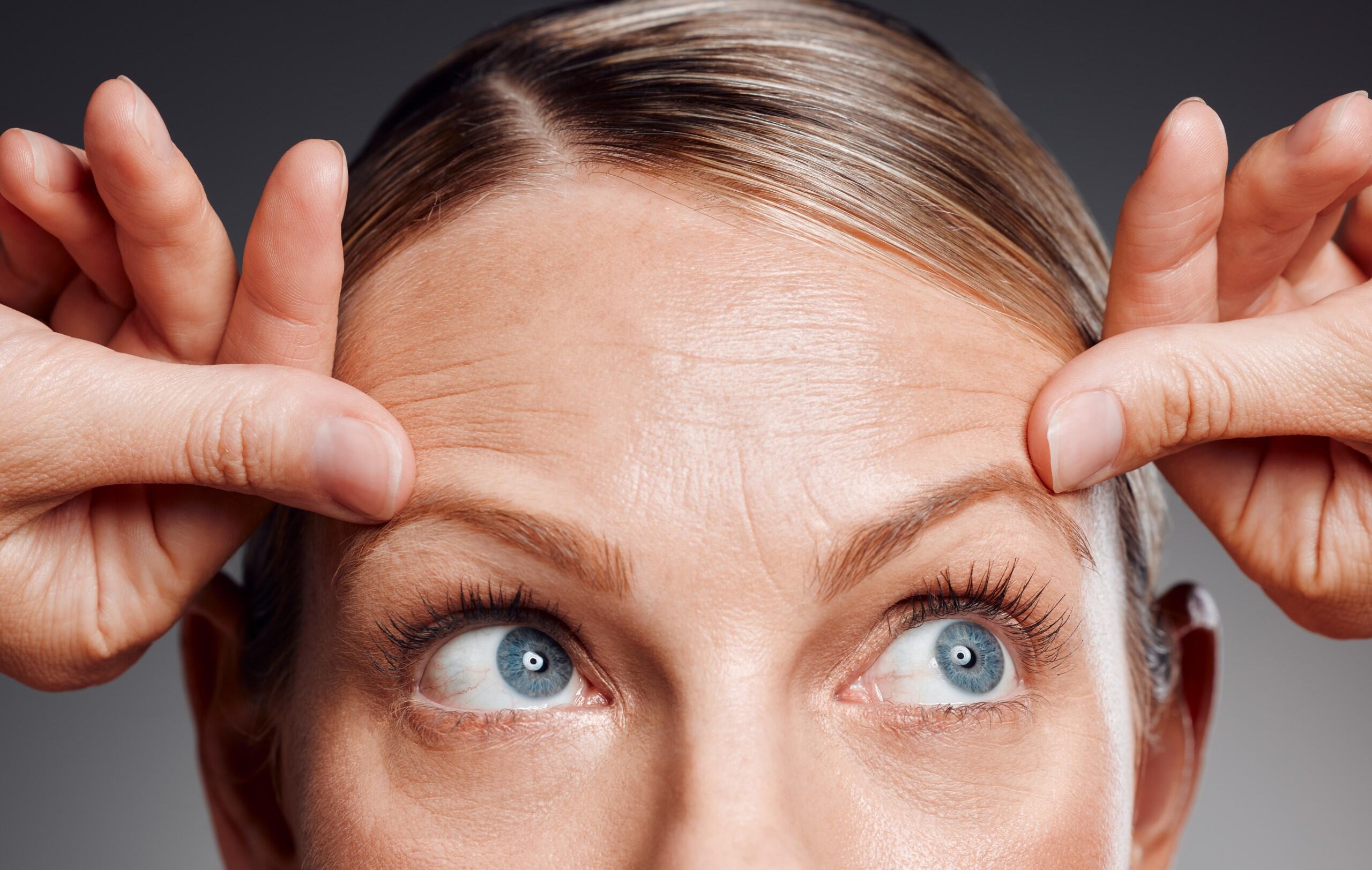 Wrinkles and fine lines image 2