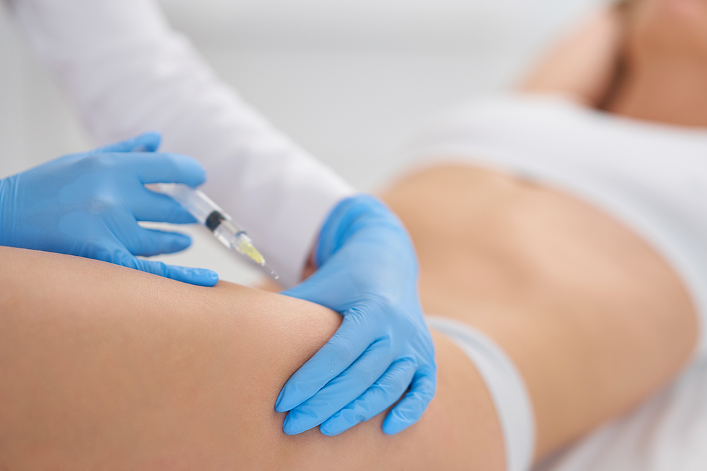 Lipolytic treatment image 3