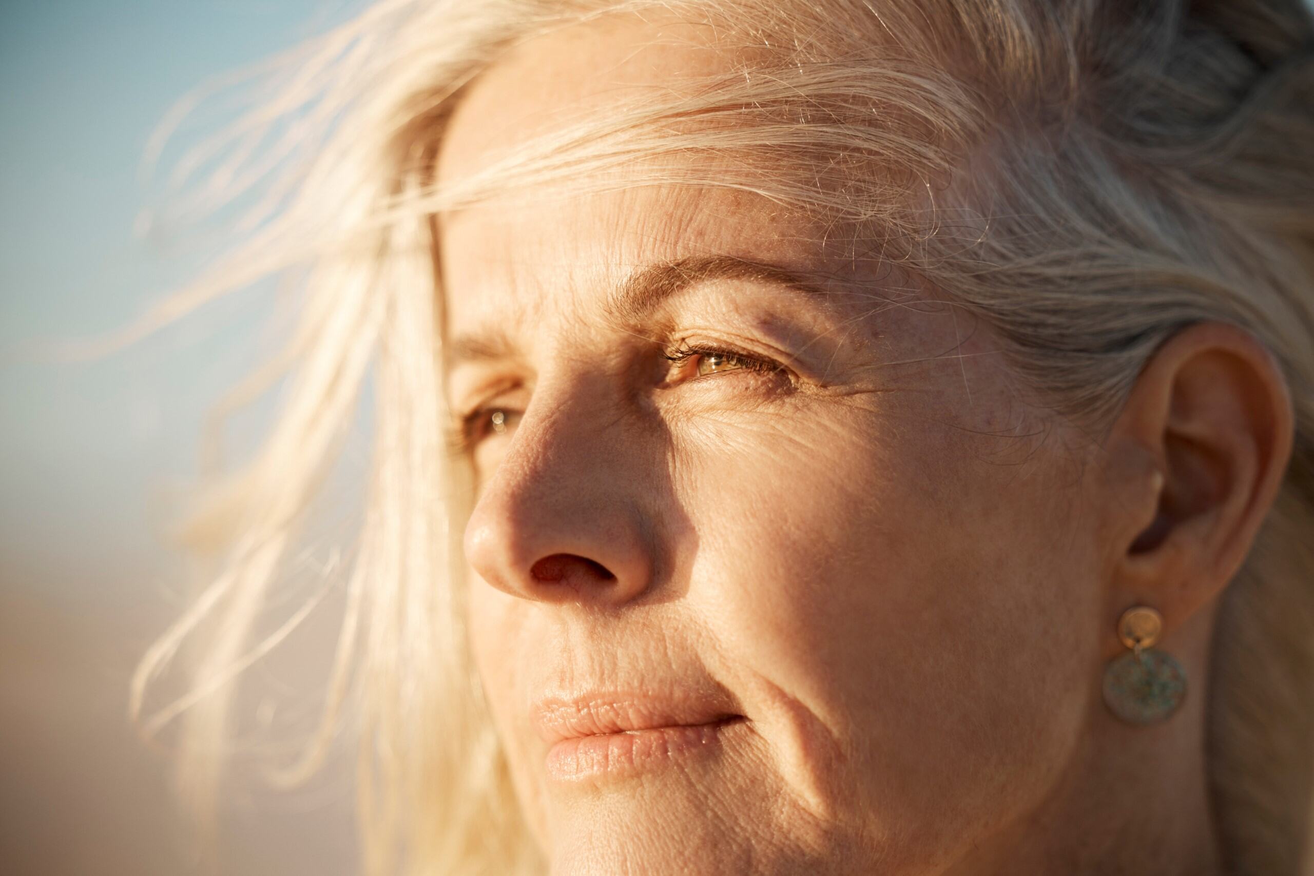 Wrinkles and fine lines image 3