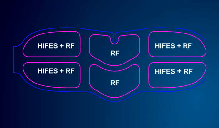 emface scheme image 1