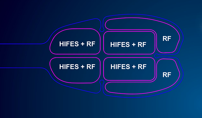 emface scheme image 2