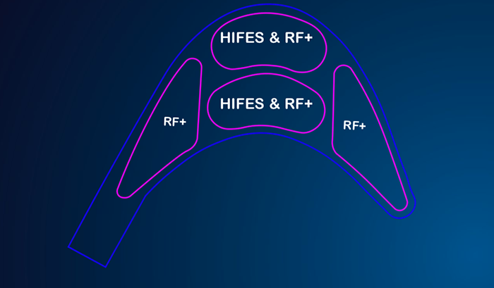 emface scheme image 3