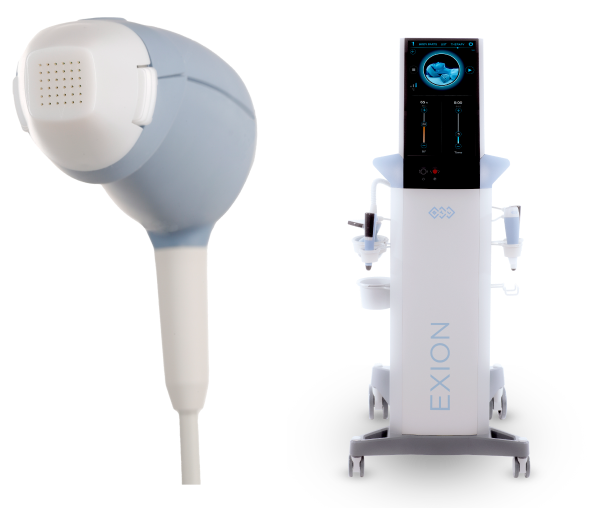 exion rf neulaton